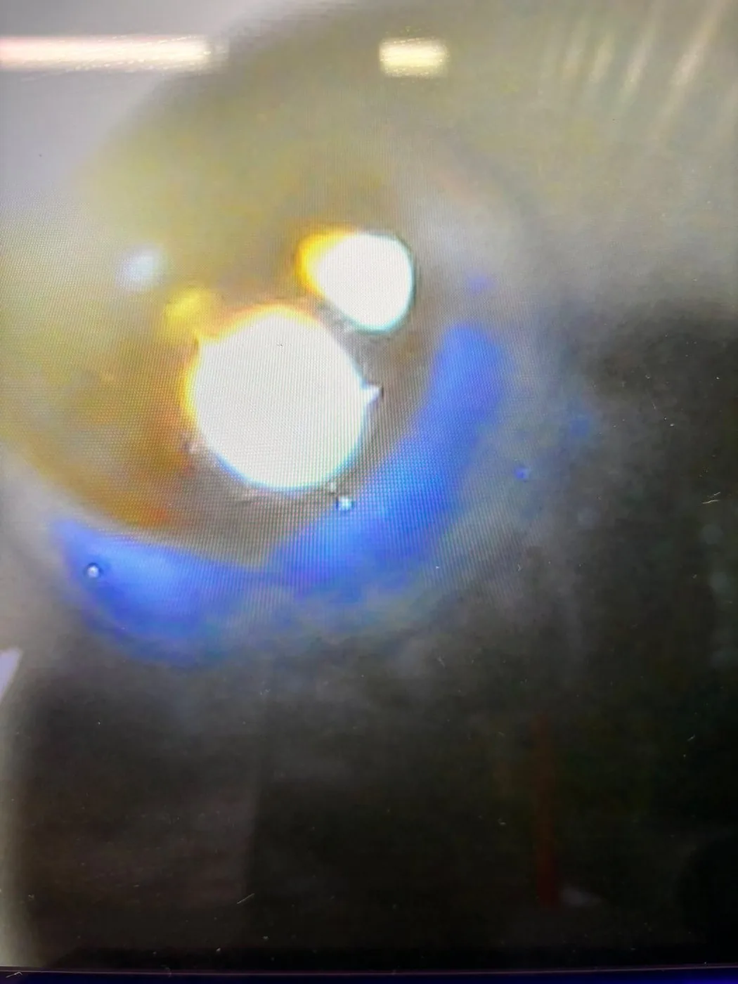 Runde Laseroptik im Gegenlicht, mit anhaftenden Spritzern